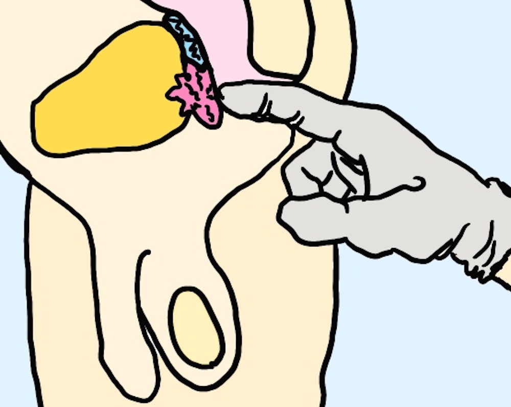 アナルへの指挿入の図解